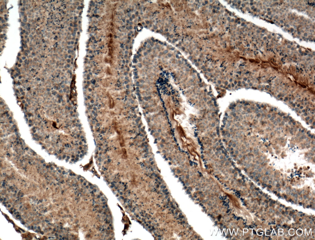 Immunohistochemistry (IHC) staining of mouse testis tissue using HERC5 Polyclonal antibody (22692-1-AP)