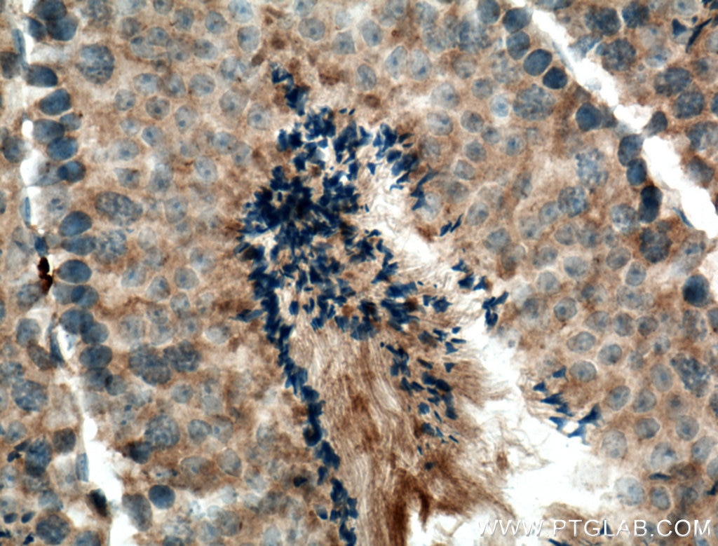 Immunohistochemistry (IHC) staining of mouse testis tissue using HERC5 Polyclonal antibody (22692-1-AP)