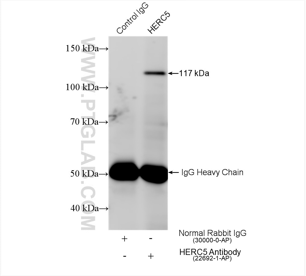 IP result of anti-HERC5 (IP:22692-1-AP, 4ug; Detection:22692-1-AP 1:500) with HEK-293 cells lysate 1400 ug. Immunoprecipitation (IP) experiment of HEK-293 cells using HERC5 Polyclonal antibody (22692-1-AP)