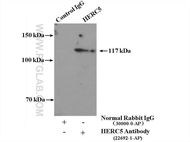 IP experiment of HEK-293 using 22692-1-AP