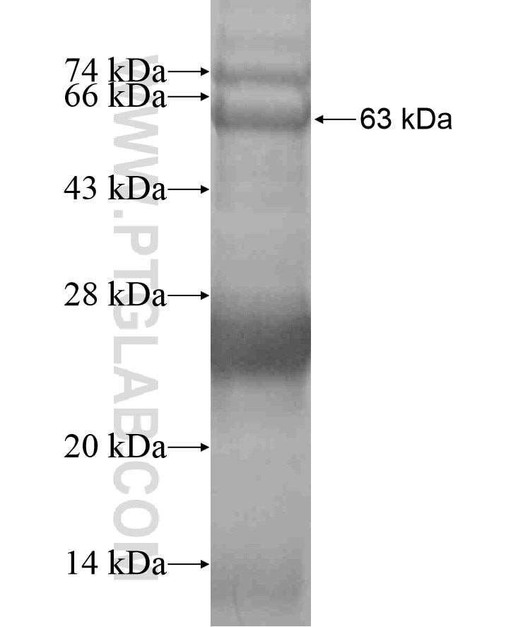 HERC5 fusion protein Ag18449 SDS-PAGE