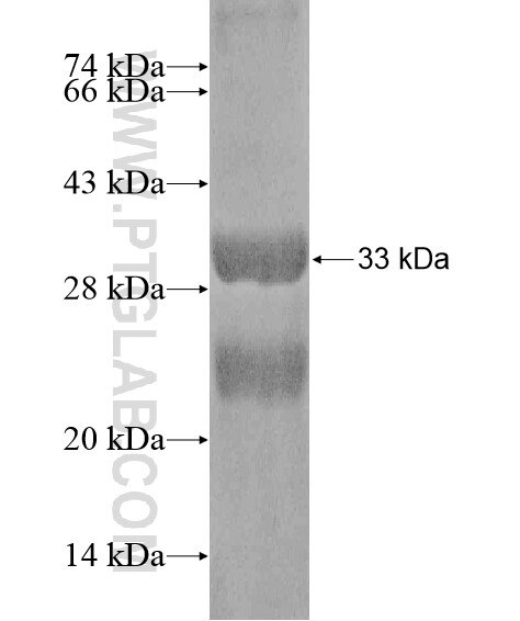 HERC6 fusion protein Ag20302 SDS-PAGE