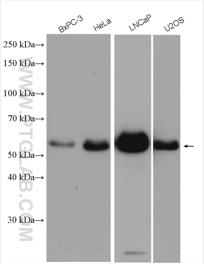Western Blot (WB) analysis of various lysates using HERP Polyclonal antibody (10813-1-AP)