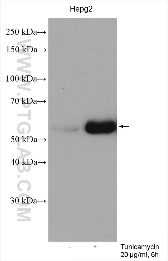 Western Blot (WB) analysis of various lysates using HERP Polyclonal antibody (10813-1-AP)