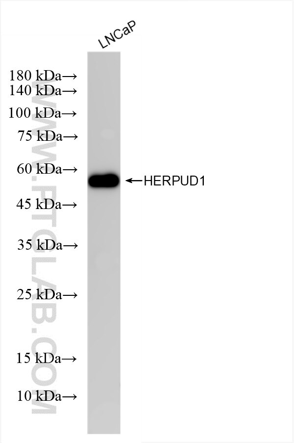 Western Blot (WB) analysis of LNCaP cells using HERPUD1 Recombinant antibody (85627-1-RR)