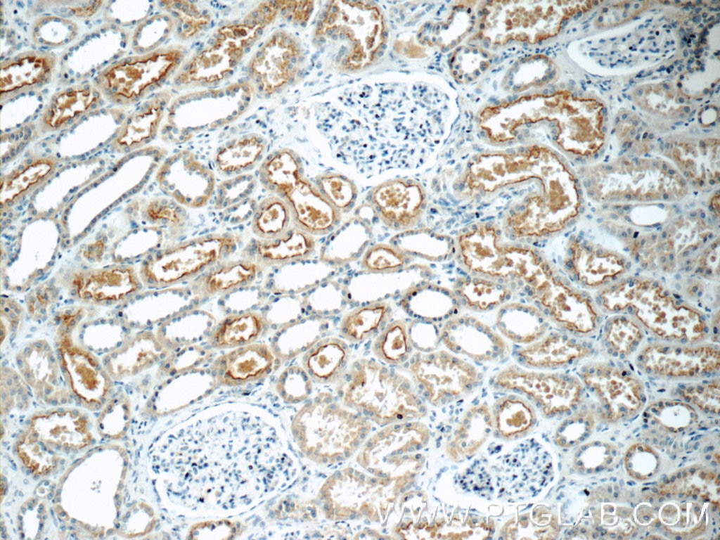 Immunohistochemistry (IHC) staining of human kidney tissue using HERPUD2 Polyclonal antibody (20640-1-AP)