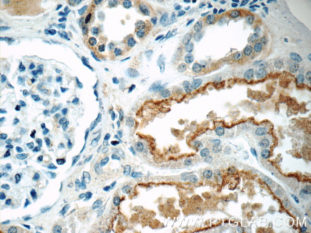 Immunohistochemistry (IHC) staining of human kidney tissue using HERPUD2 Polyclonal antibody (20640-1-AP)
