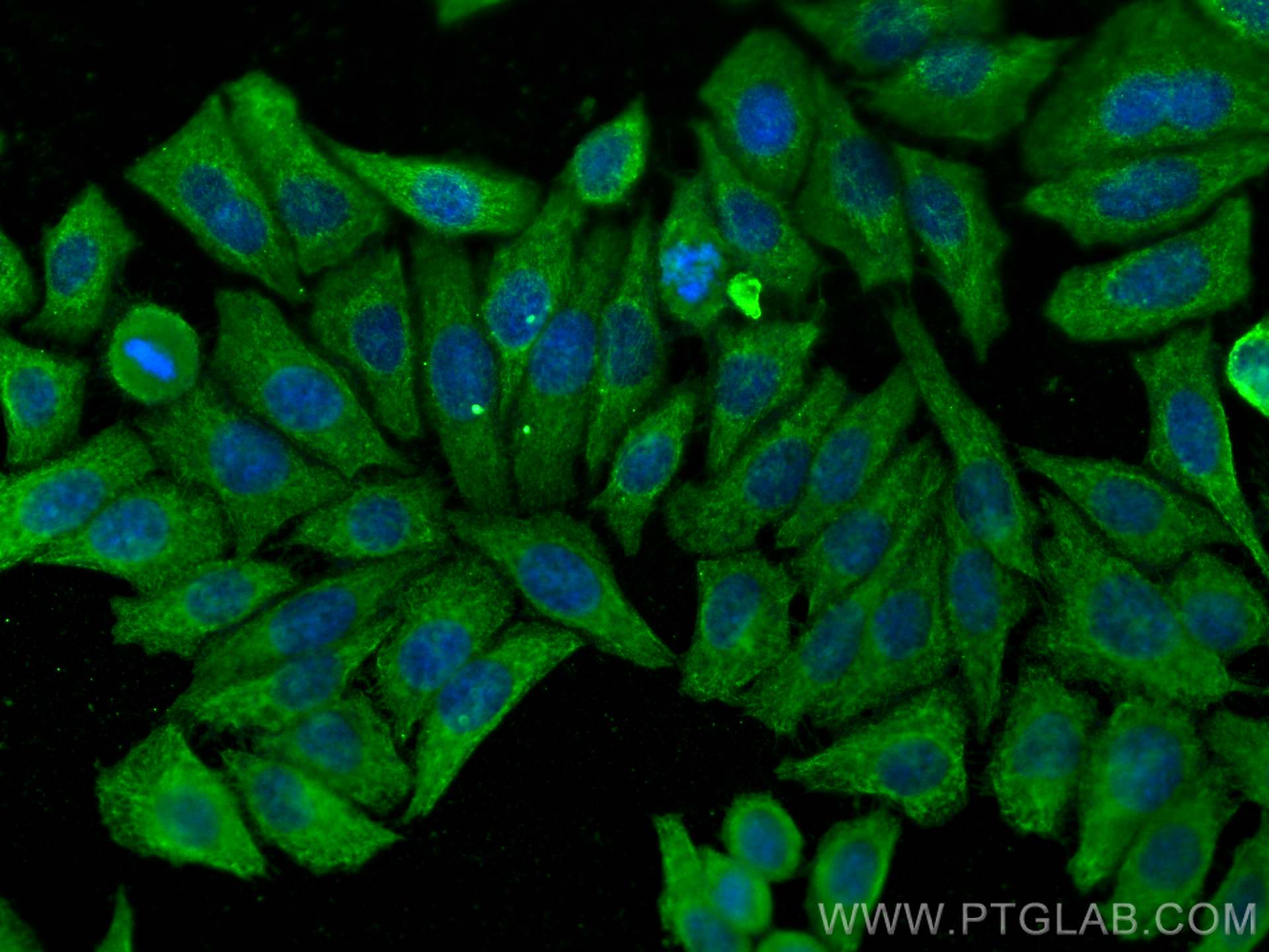 Immunofluorescence (IF) / fluorescent staining of HepG2 cells using HERPUD2 Monoclonal antibody (68427-1-Ig)