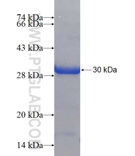 HERPUD2 fusion protein Ag15007 SDS-PAGE