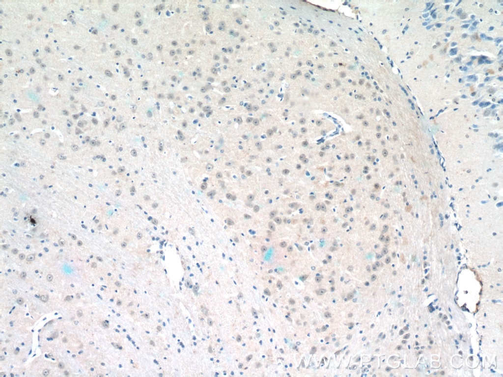 Immunohistochemistry (IHC) staining of mouse brain tissue using HES5 Polyclonal antibody (22666-1-AP)