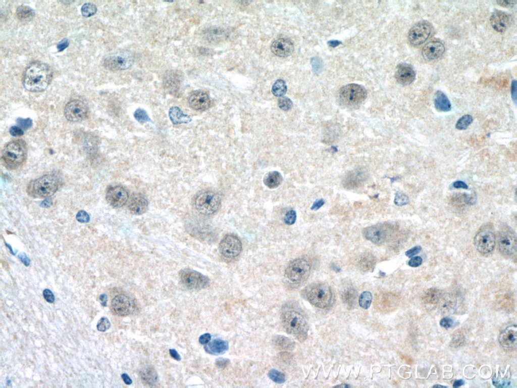 IHC staining of mouse brain using 22666-1-AP