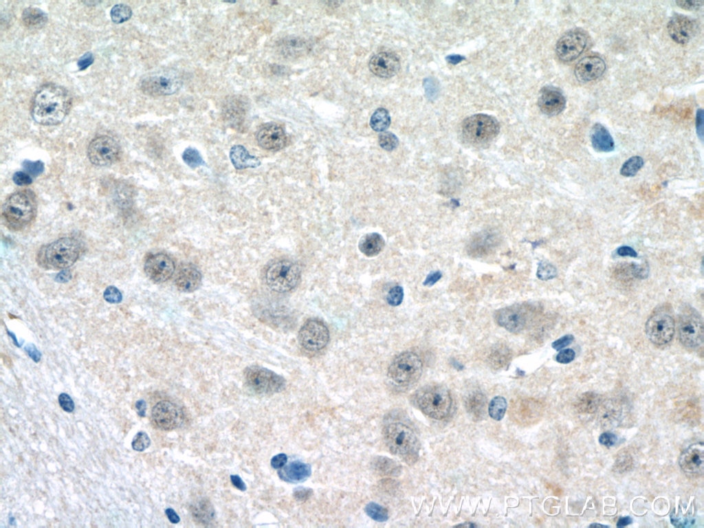 Immunohistochemistry (IHC) staining of mouse brain tissue using HES5 Polyclonal antibody (22666-1-AP)