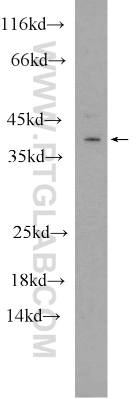 Western Blot (WB) analysis of rat brain tissue using HES5 Polyclonal antibody (22666-1-AP)