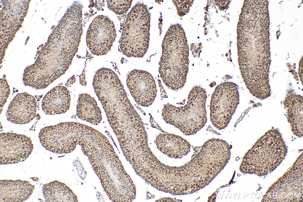 Immunohistochemistry (IHC) staining of mouse testis tissue using HESX1 Polyclonal antibody (17927-1-AP)