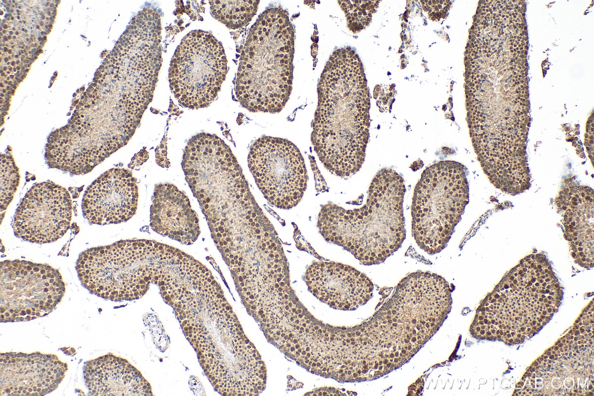 IHC staining of mouse testis using 17927-1-AP