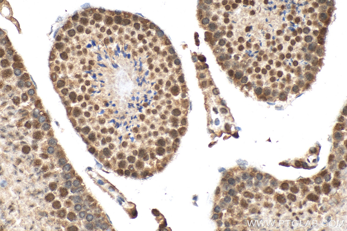 Immunohistochemistry (IHC) staining of mouse testis tissue using HESX1 Polyclonal antibody (17927-1-AP)