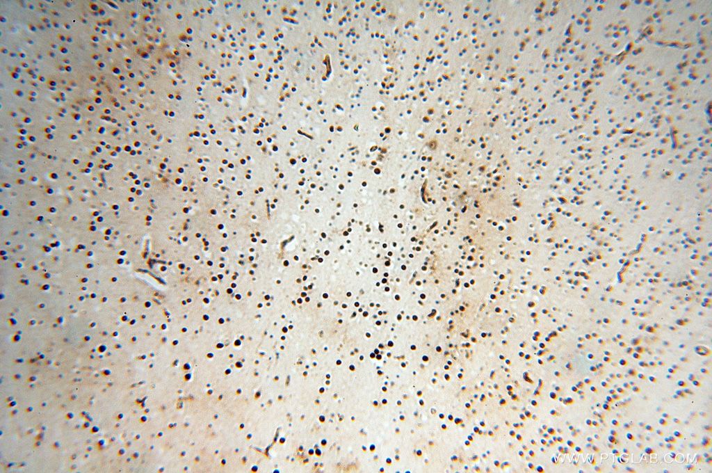 HESX1 Polyclonal antibody