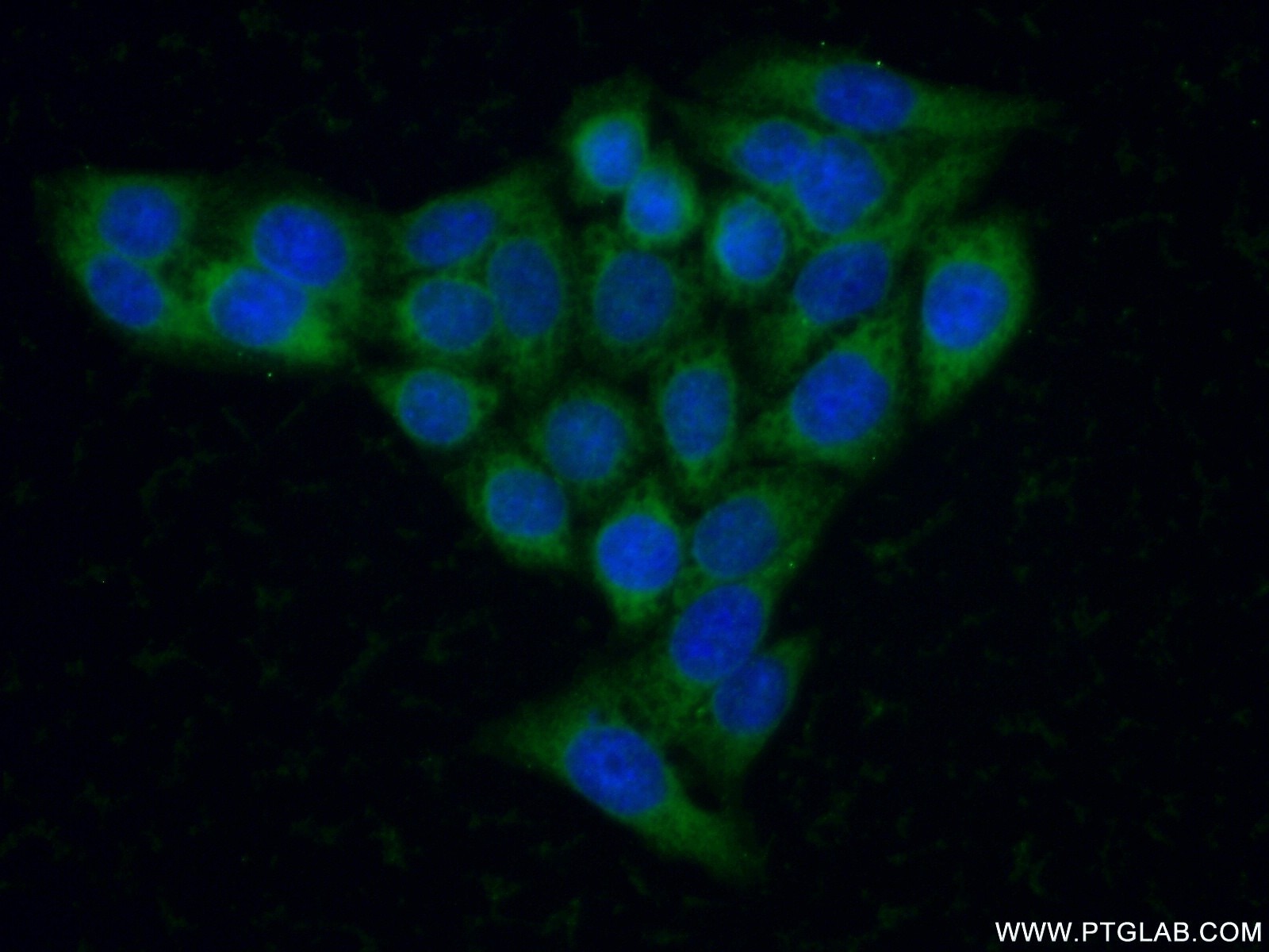 Immunofluorescence (IF) / fluorescent staining of PC-3 cells using HEXA Polyclonal antibody (11317-1-AP)