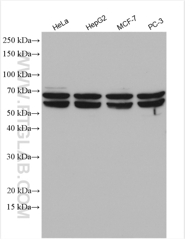Western Blot (WB) analysis of various lysates using HEXA Polyclonal antibody (11317-1-AP)