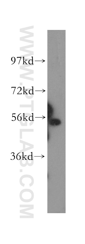 HEXA Polyclonal antibody