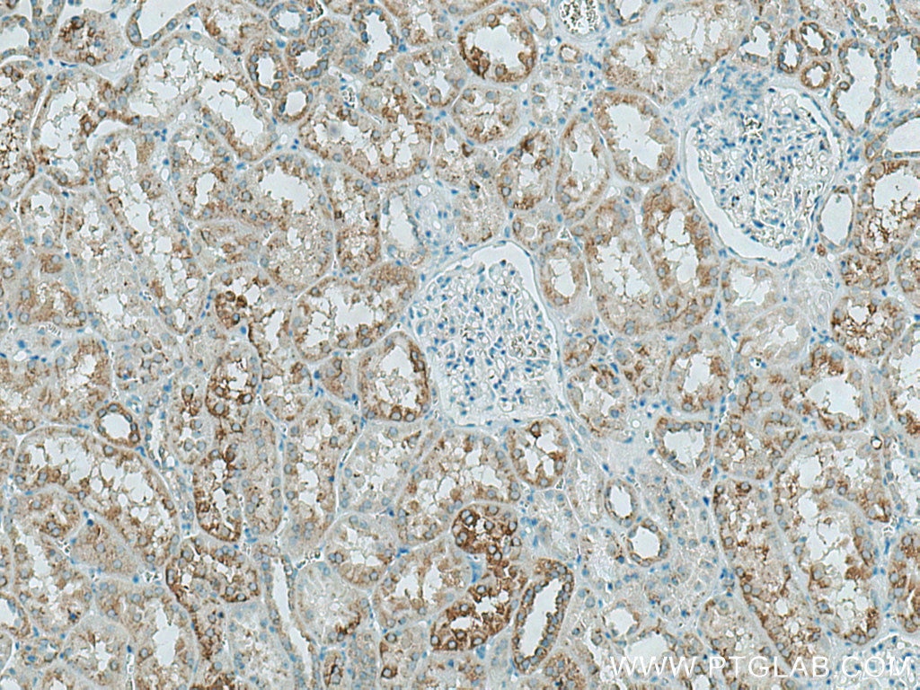 Immunohistochemistry (IHC) staining of human kidney tissue using HEXA Polyclonal antibody (29259-1-AP)