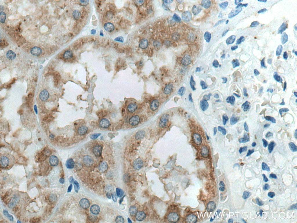 Immunohistochemistry (IHC) staining of human kidney tissue using HEXA Polyclonal antibody (29259-1-AP)