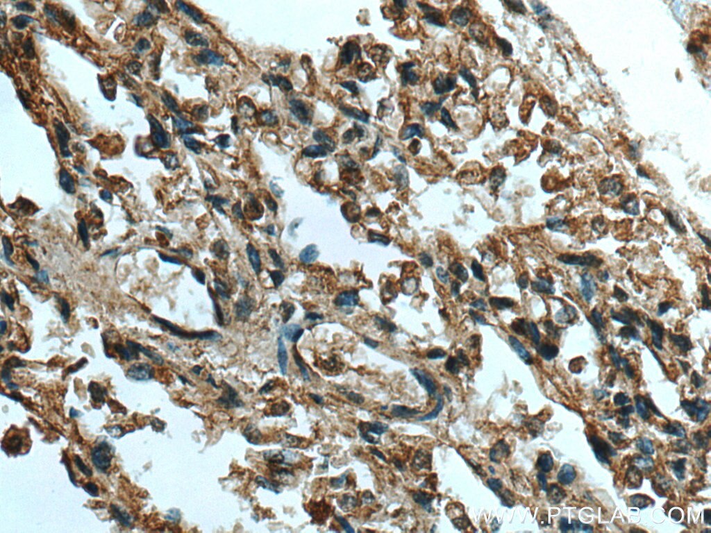 Immunohistochemistry (IHC) staining of human lung tissue using HEXA Polyclonal antibody (29259-1-AP)