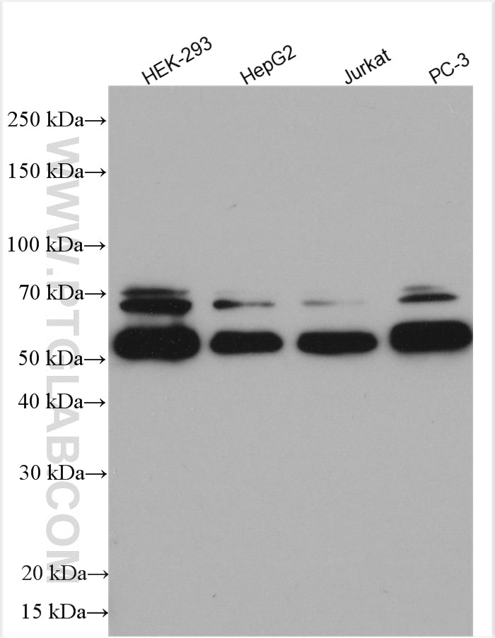 Western Blot (WB) analysis of various lysates using HEXA Polyclonal antibody (29259-1-AP)