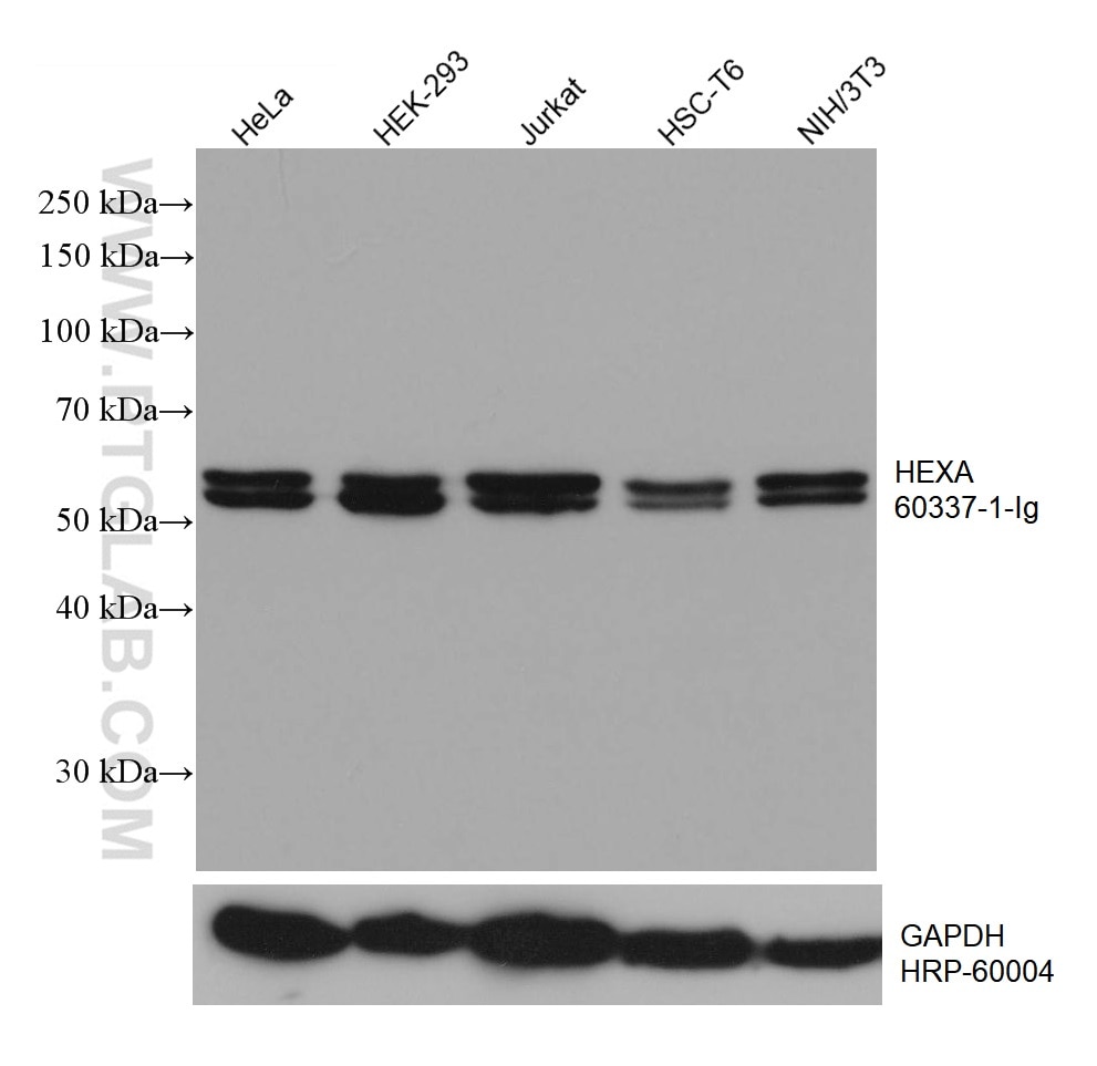 Western Blot (WB) analysis of various lysates using HEXA Monoclonal antibody (60337-1-Ig)