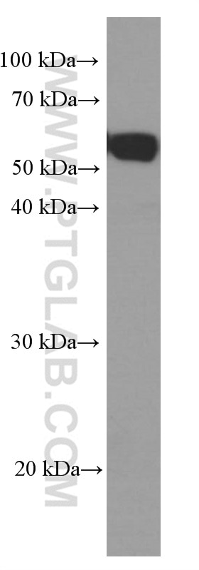 Western Blot (WB) analysis of A431 cells using HEXA Monoclonal antibody (60337-1-Ig)