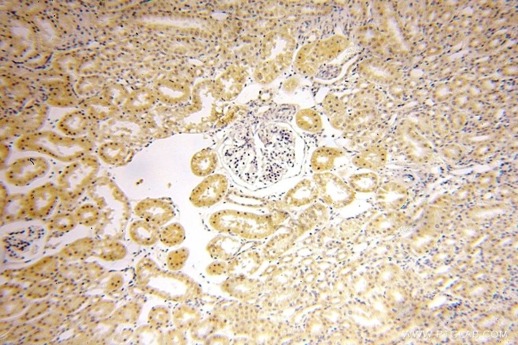 Immunohistochemistry (IHC) staining of human kidney tissue using HEXB Polyclonal antibody (16229-1-AP)