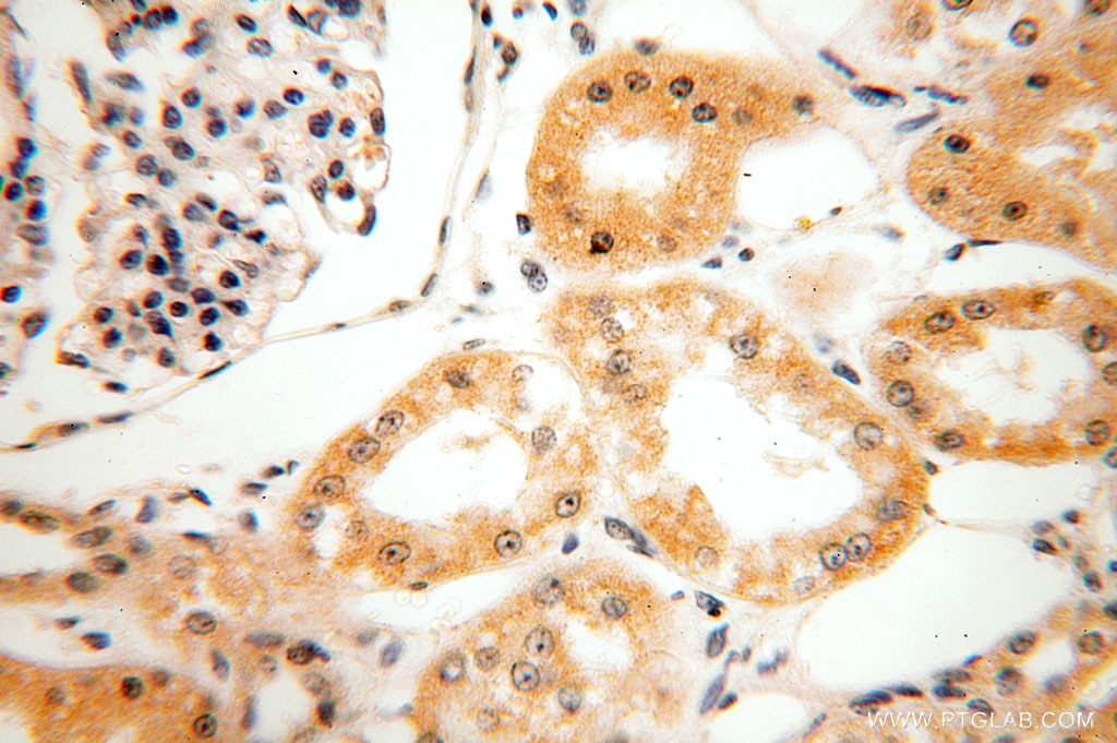 Immunohistochemistry (IHC) staining of human kidney tissue using HEXB Polyclonal antibody (16229-1-AP)