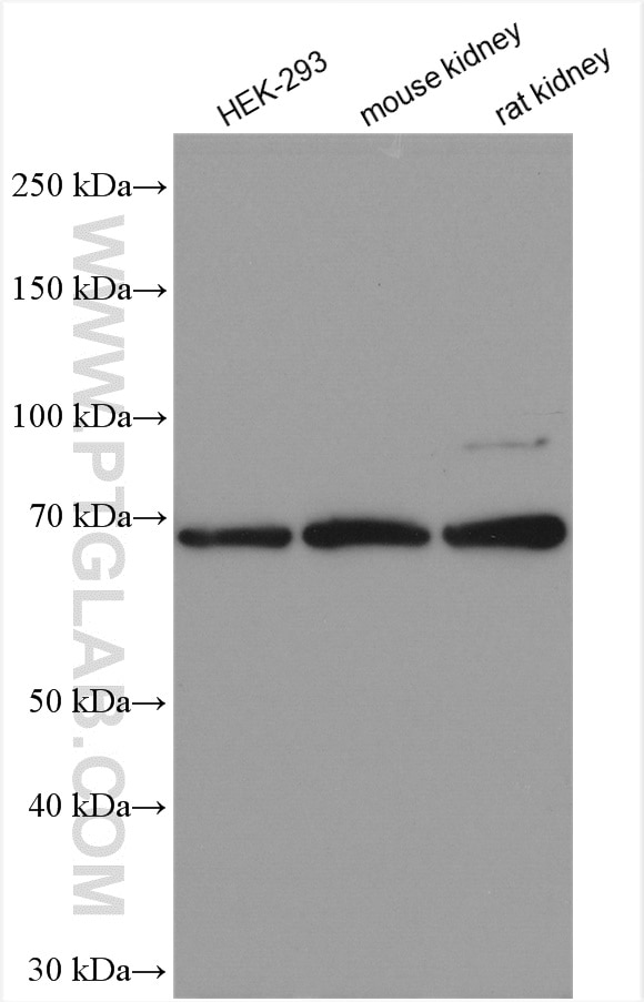 Western Blot (WB) analysis of various lysates using HEXB Polyclonal antibody (16229-1-AP)