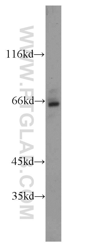 Western Blot (WB) analysis of HeLa cells using HEXB Polyclonal antibody (16229-1-AP)