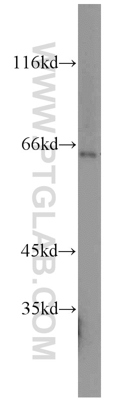 Western Blot (WB) analysis of mouse lung tissue using HEXB Polyclonal antibody (16229-1-AP)