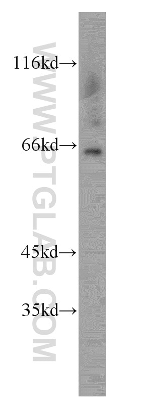 Western Blot (WB) analysis of HEK-293 cells using HEXB Polyclonal antibody (16229-1-AP)