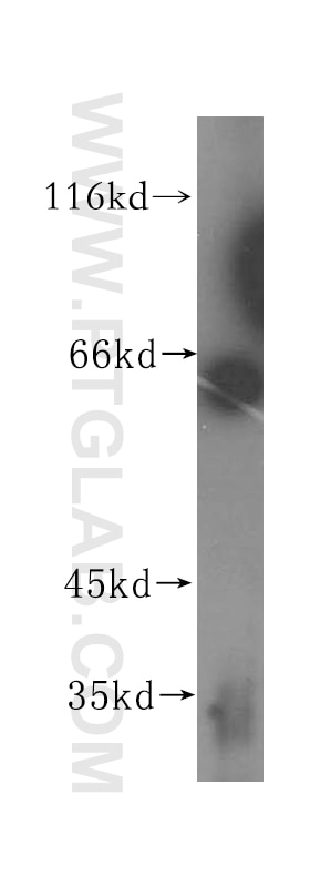 Western Blot (WB) analysis of mouse kidney tissue using HEXB Polyclonal antibody (16229-1-AP)