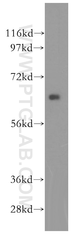 Western Blot (WB) analysis of Jurkat cells using HEXB Polyclonal antibody (16229-1-AP)
