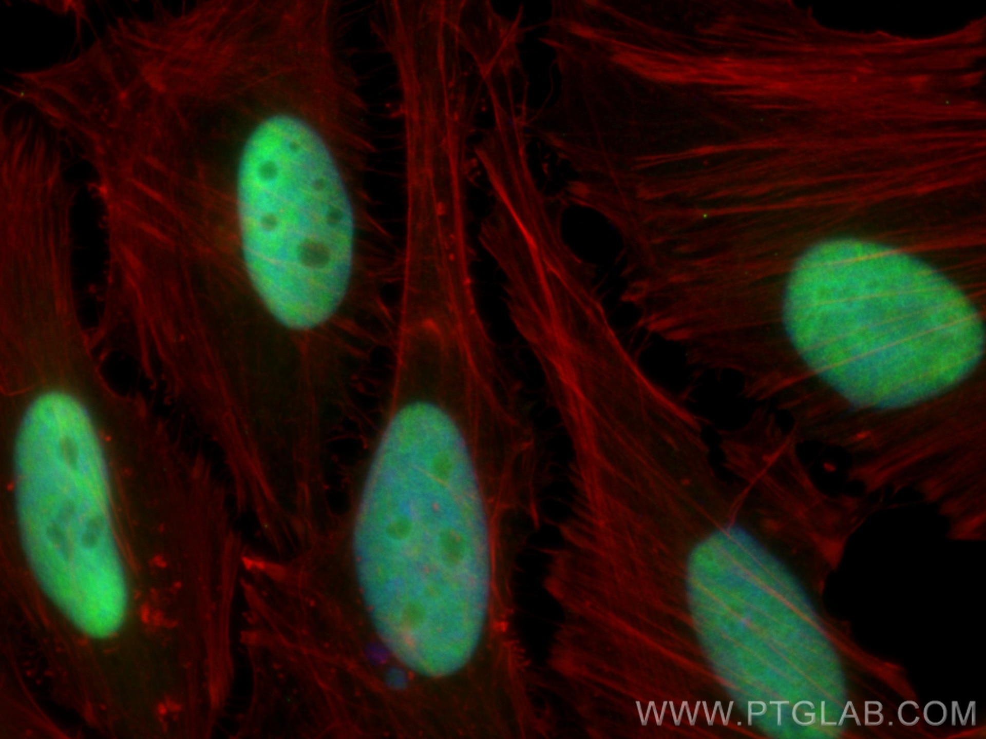 Immunofluorescence (IF) / fluorescent staining of HeLa cells using HEXIM1 Polyclonal antibody (15676-1-AP)