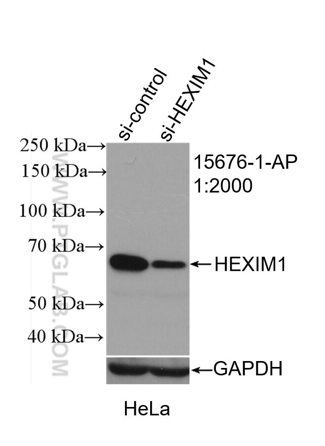 Western Blot (WB) analysis of HeLa cells using HEXIM1 Polyclonal antibody (15676-1-AP)