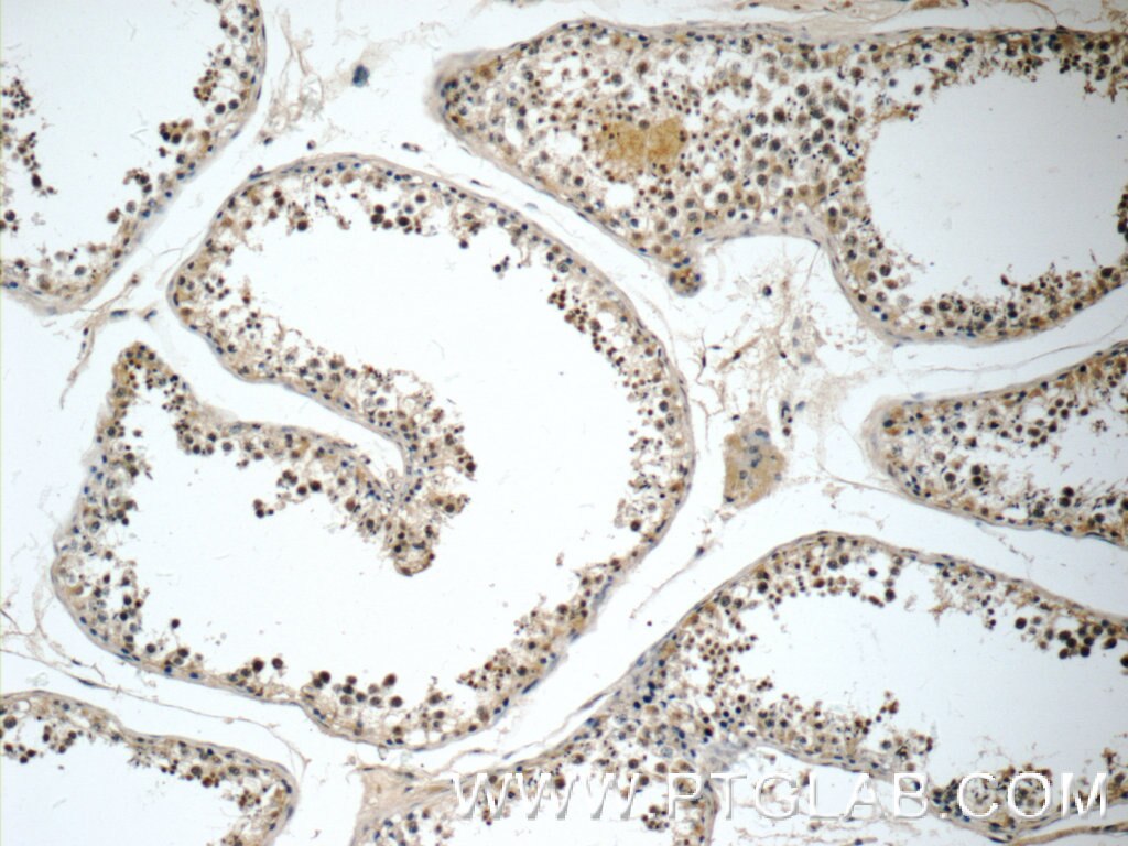 Immunohistochemistry (IHC) staining of human testis tissue using HEXIM2 Polyclonal antibody (16598-1-AP)