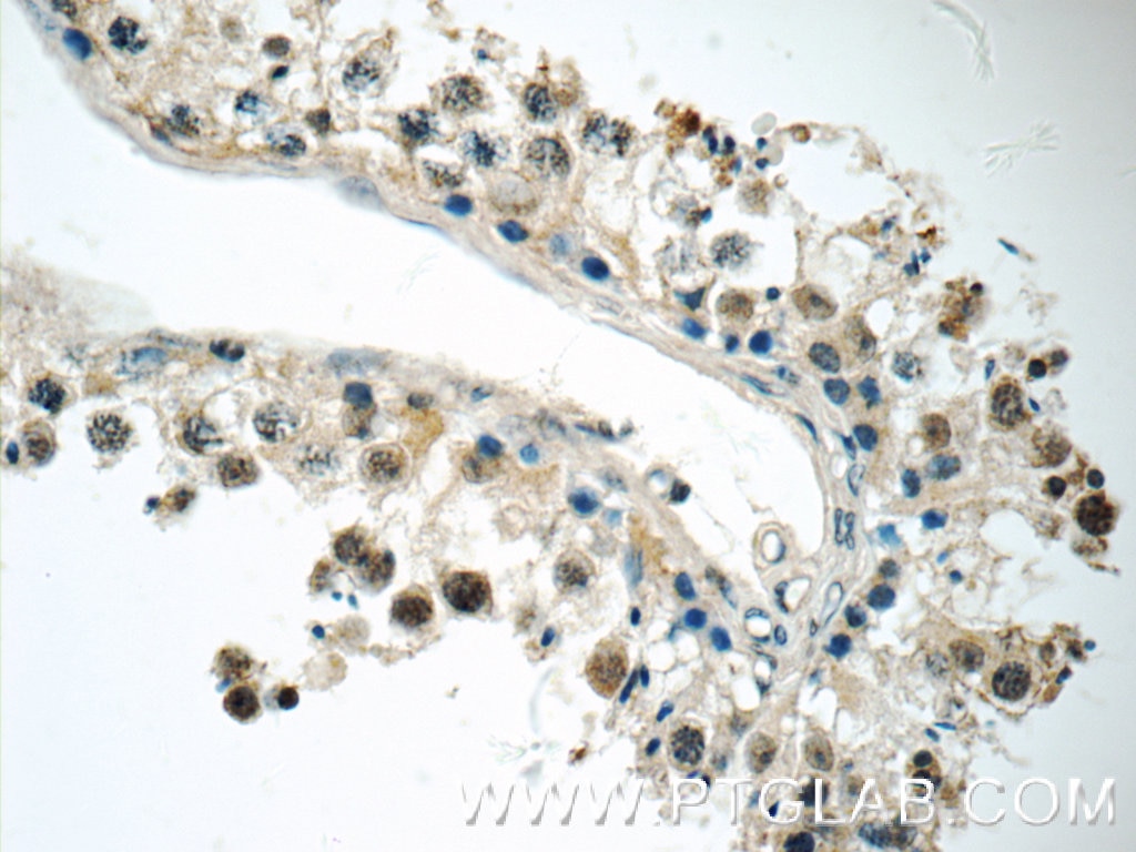 Immunohistochemistry (IHC) staining of human testis tissue using HEXIM2 Polyclonal antibody (16598-1-AP)
