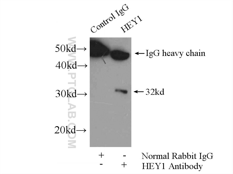 Immunoprecipitation (IP) experiment of mouse kidney tissue using HEY1 Polyclonal antibody (19929-1-AP)