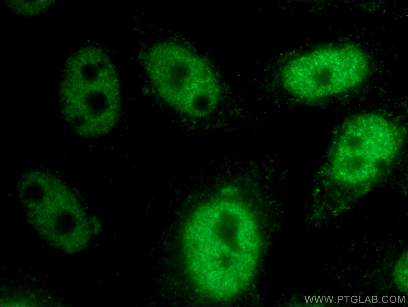 Immunofluorescence (IF) / fluorescent staining of HepG2 cells using HEY2 Polyclonal antibody (10597-1-AP)