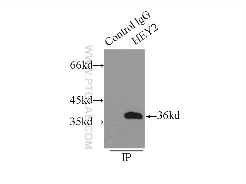 Immunoprecipitation (IP) experiment of mouse heart tissue using HEY2 Polyclonal antibody (10597-1-AP)