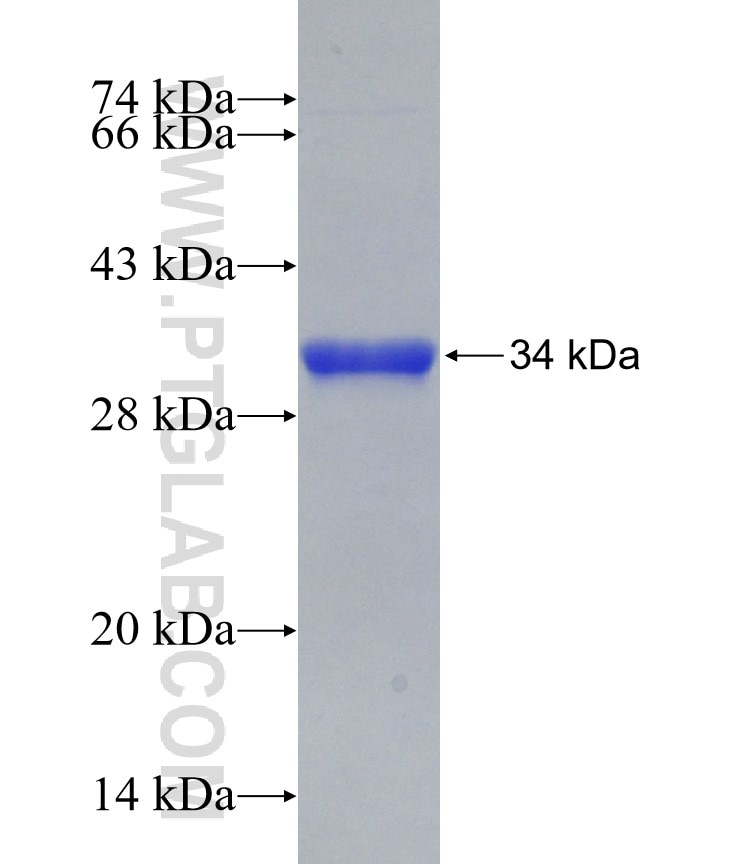 HEY2 fusion protein Ag31263 SDS-PAGE