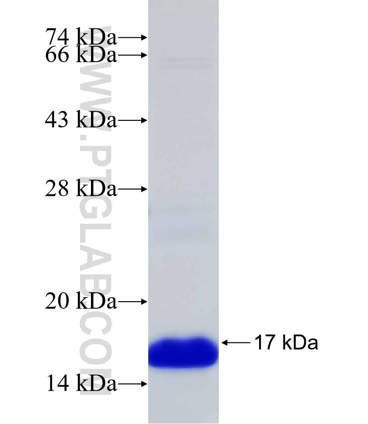 HEY2 fusion protein Ag31307 SDS-PAGE