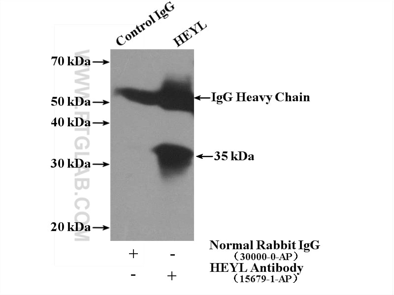 Immunoprecipitation (IP) experiment of HeLa cells using HEYL Polyclonal antibody (15679-1-AP)