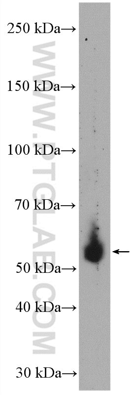 Western Blot (WB) analysis of human placenta tissue using HFE Polyclonal antibody (17954-1-AP)