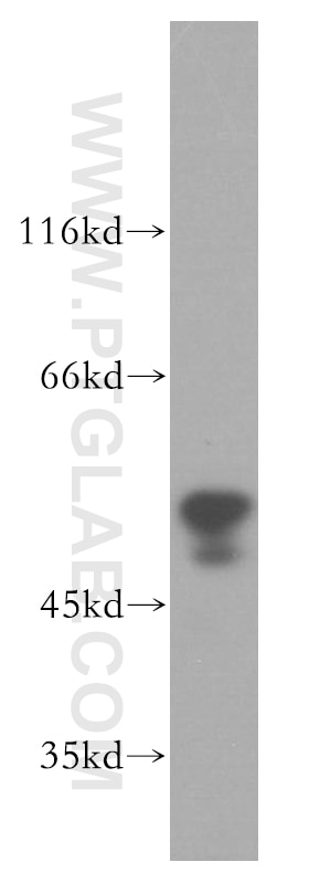 Western Blot (WB) analysis of A375 cells using HFE Polyclonal antibody (17954-1-AP)